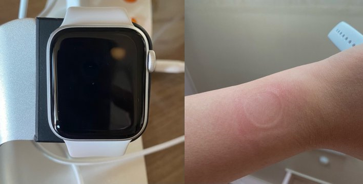 Apple watch best sale overheating while wearing