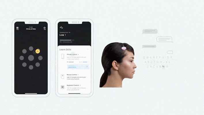 Neuralink İlk İnsan Beyni İmplantıyla Tarih Yazıyor