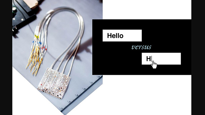 ucsf neuroprosthesis