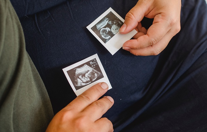 image of embryo