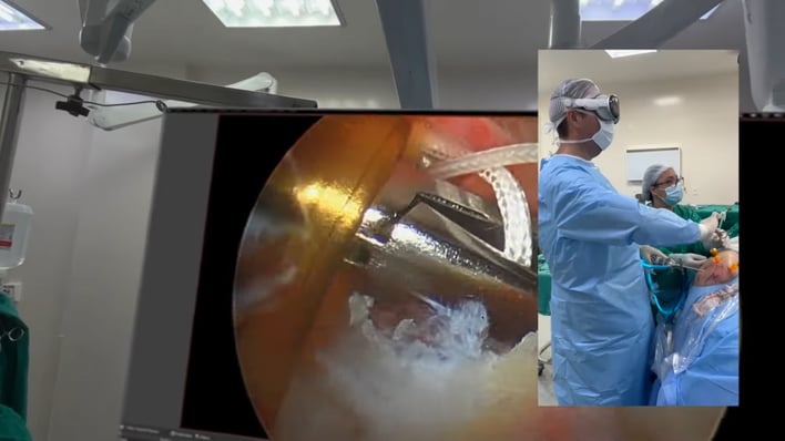 brazilian doctor uses apple vision pro in rotator cuff surgery