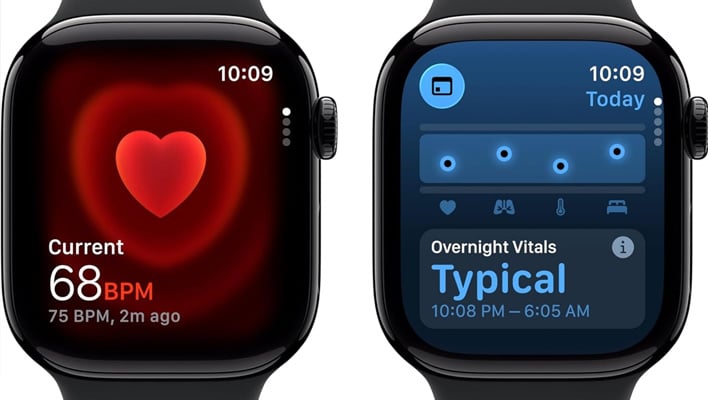 Apple Watch Series 11 Deal Slashes $100 Off Just In Time For 2026