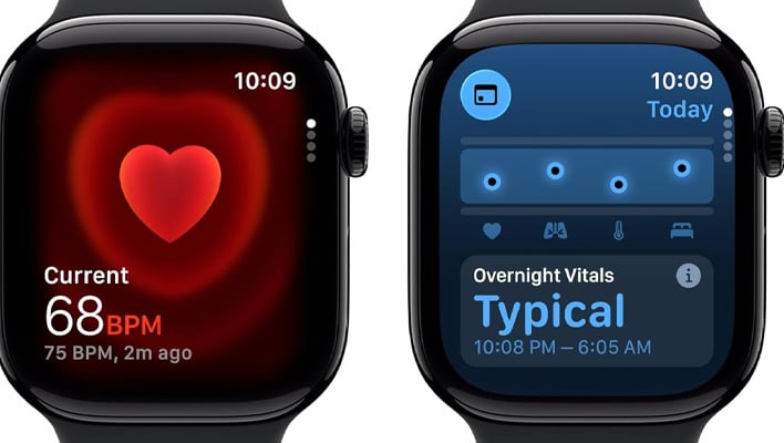 Apple Watch Series 11 renders.