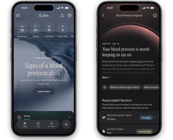 blood pressure signals oura1