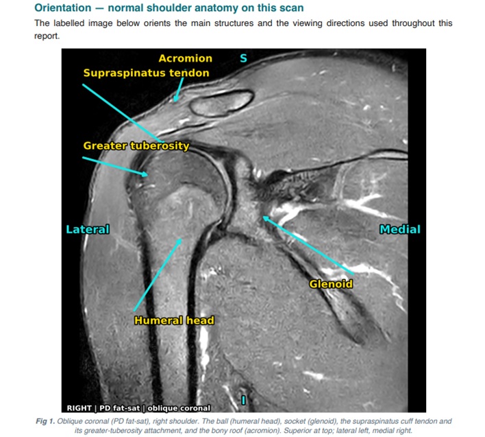 mri image for claude analysis